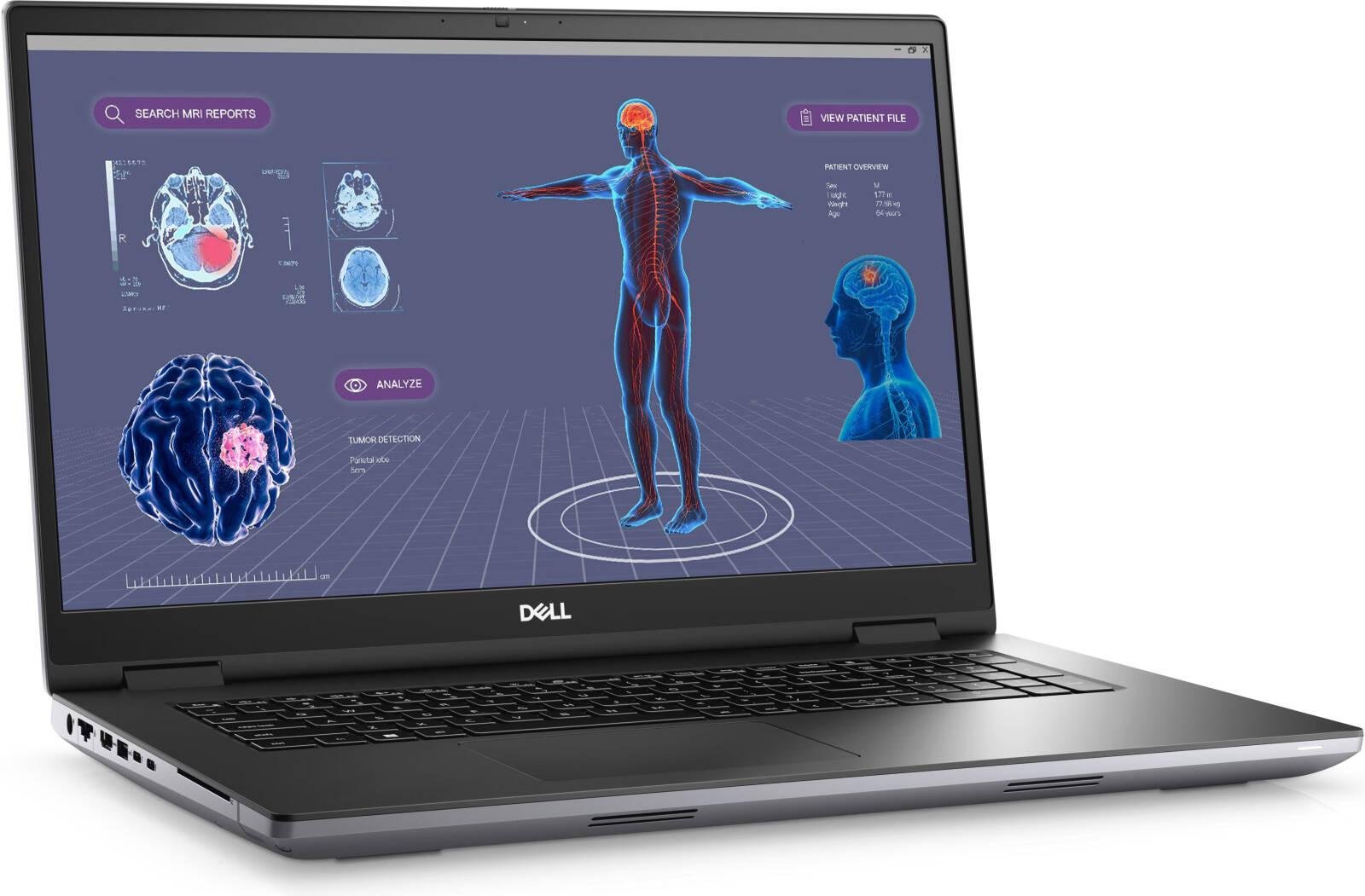 Dell Precision 7780 Workstation Laptop, 17.3" FHD 60Hz Display, Intel Core i9-13950HX vPro, 32GB RAM, 1TB SSD, NVIDIA RTX 2000 Ada 8GB GPU, English US K/B, Win 11 Pro, Grey | Prec-7780